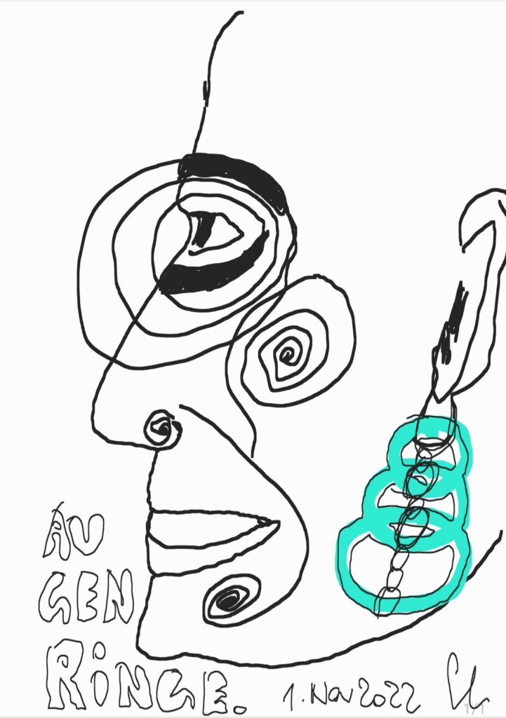 Augenringe – Ansicht 1